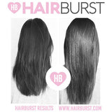 hair growth vitamins, hair growth, biotin, hairburst, longer hair,
